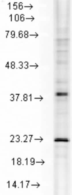 HSPB8/HSP22 Antibody (3C12-H11), Novus Biologicals 0.1 mg | Buy Online | Novus Biologicals | Fisher Scientific